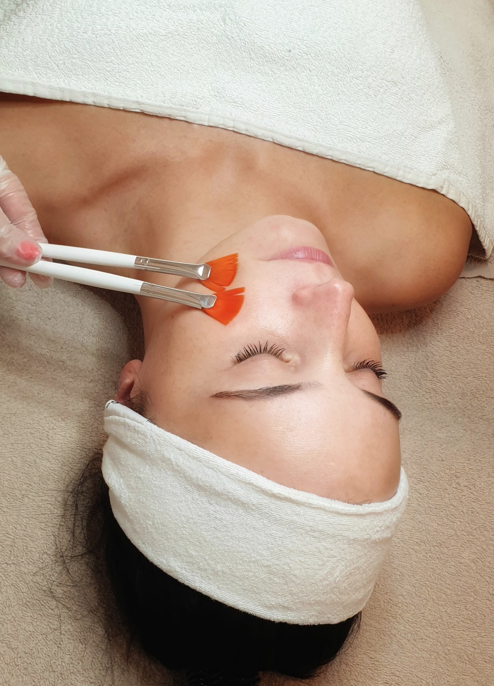 Chemical peeling beauty treatment being done on a woman